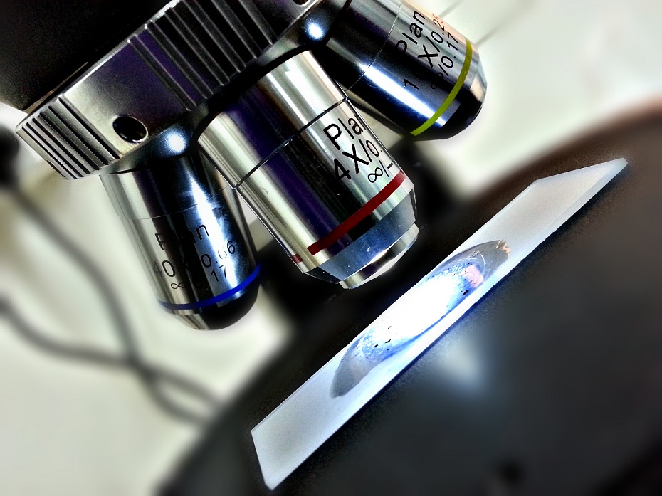 the three lenses of a microscope